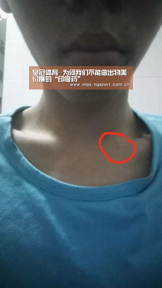 皇冠娱乐
